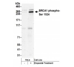 BRCA1, p Ser1524 Antibody, Novus Biologicals 0.1mg; Unlabeled:Antikörper
